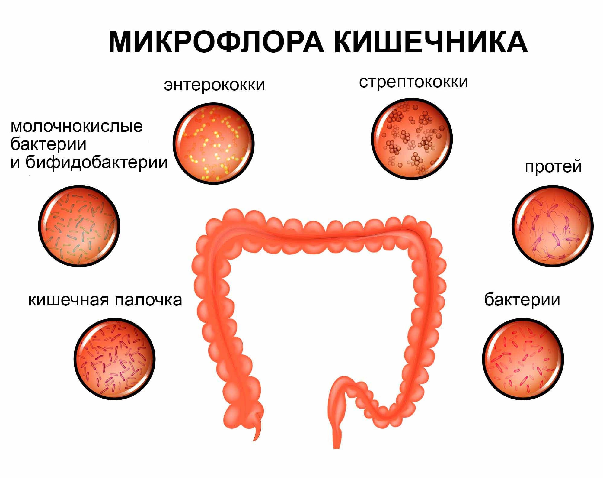 Дисбактериоз у новорожденных: причины, симптомы и методы лечения