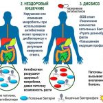 Эффективные методы диагностики и лечения кишечной бактериальной инфекции