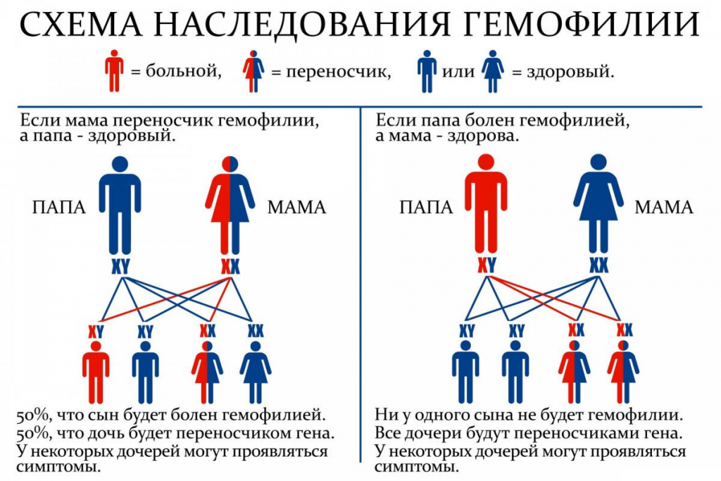 Гемофилия: что это за болезнь, её симптомы и причины возникновения