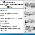 Гипостатура: причины, симптомы и методы лечения этого заболевания