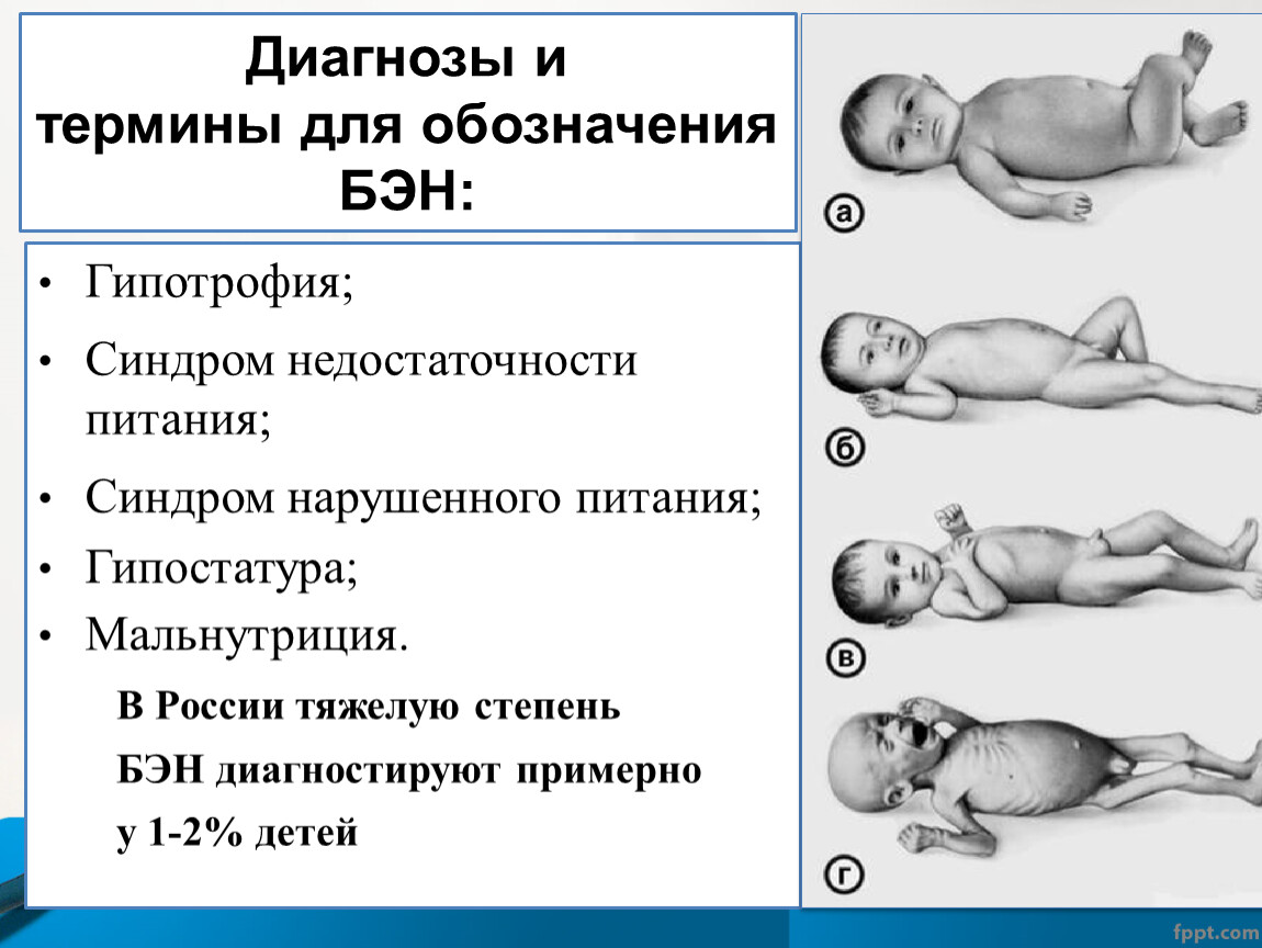 Гипостатура: причины, симптомы и методы лечения этого заболевания