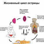 Как распознать острицы: основные симптомы и методы диагностики