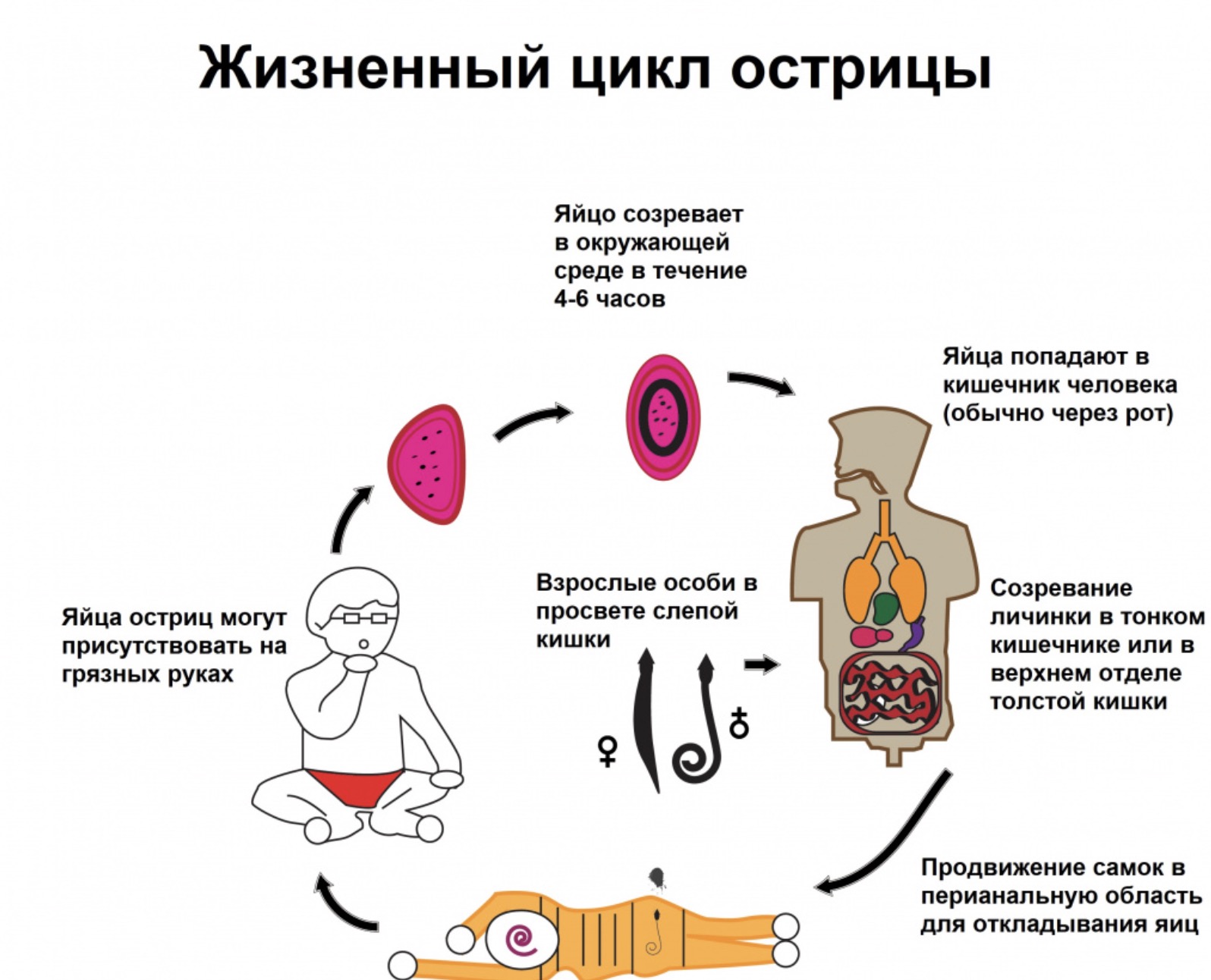 Как распознать острицы: основные симптомы и методы диагностики