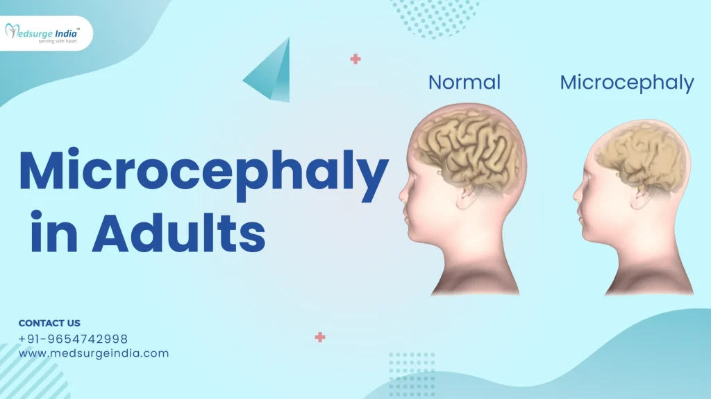 Микроцефалия: Причины, симптомы и современные методы лечения