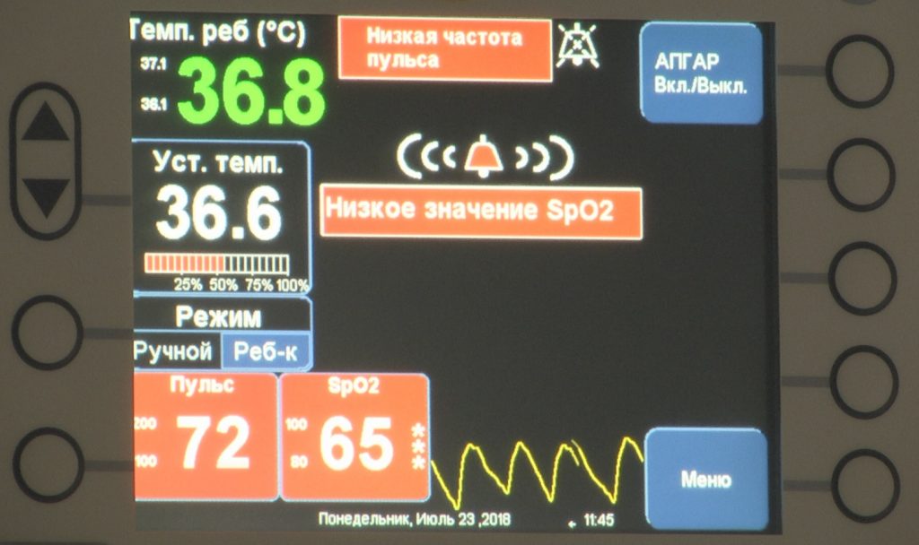 Шкала Апгар: Ключевой инструмент для оценки состояния новорожденных