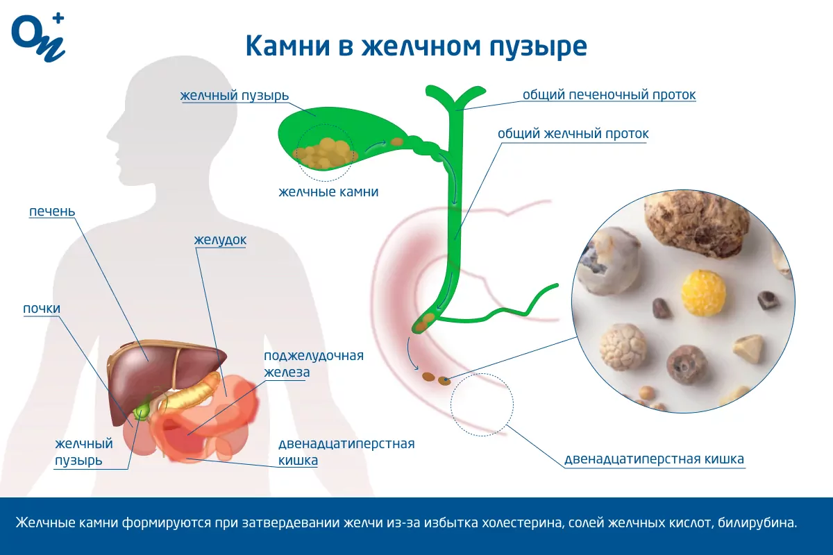 Увеличен желчный пузырь у ребенка: причины, симптомы и лечение